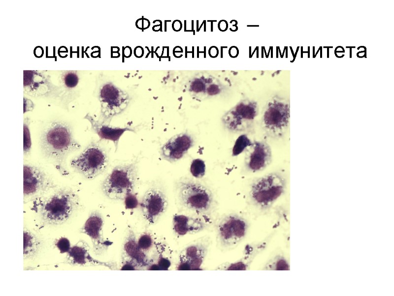 Фагоцитоз –  оценка врожденного иммунитета